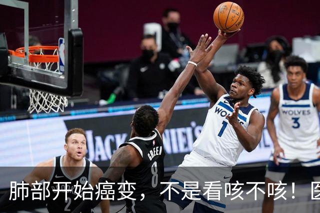 肺部开始癌变，不是看咳不咳！医生提醒：若发现3个异常或已患癌